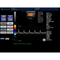 máquina do ecocardiograma de Doppler da cor &amp; ultra-som doppler da cor